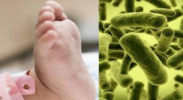 Detectan 4,000 infecciones asociadas a la atención médica en el Edomex Detectan 4,000 infecciones asociadas a la atención médica en el Edomex