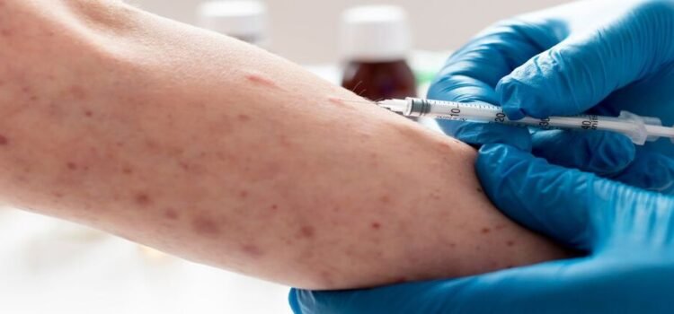 Reportan primeros 3 casos de sarampión en Edomex