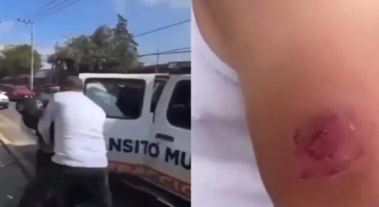 Policía muerde a automovilista durante forcejeo en Tlalnepantla