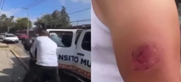 Policía muerde a automovilista durante forcejeo en Tlalnepantla