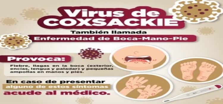 Emiten recomendaciones por virus Coxsackie en Edomex Emiten recomendaciones por virus Coxsackie en Edomex